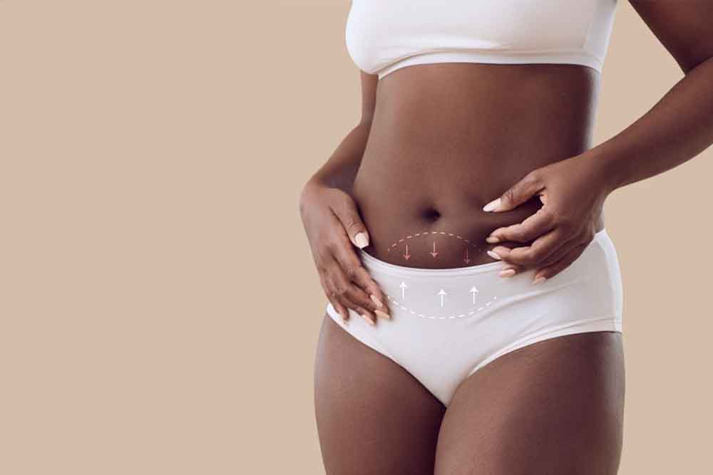 Mini Tummy Tuck